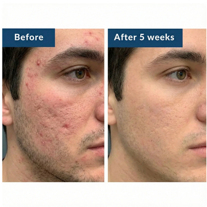 Veyora Health Copper Serum